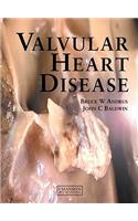 Valvular Heart Disease