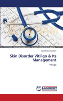 Skin Disorder Vitiligo & Its Management