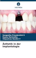 Ästhetik in der Implantologie