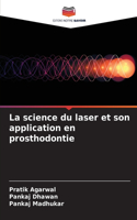 science du laser et son application en prosthodontie