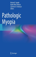 Pathologic Myopia