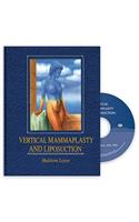 Vertical Mammaplasty and Liposuction