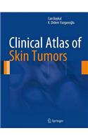 Clinical Atlas of Skin Tumors