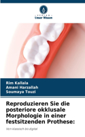 Reproduzieren Sie die posteriore okklusale Morphologie in einer festsitzenden Prothese