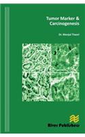 Tumor Marker and Carcinogenesis