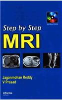 Step by Step MRI