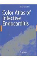 Color Atlas of Infective Endocarditis