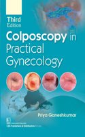 Colposcopy In Practical Gynecology