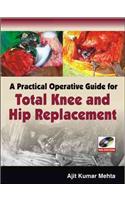 A Practical Operative Guide for Total Knee and Hip Replacement