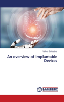 overview of Implantable Devices