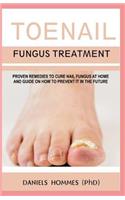 Toenail Fungus Treatment