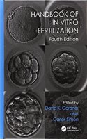 Handbook of in Vitro Fertilization