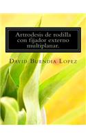 Artrodesis de rodilla con fijador externo multiplanar.
