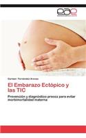 El Embarazo Ectopico y Las Tic: (Spanish)