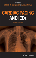 Cardiac Pacing and Icds