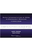 Rapid Interpretation of ECGs in Emergency Medicine