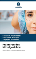 Frakturen des Mittelgesichts