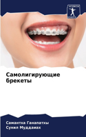 Самолигирующие брекеты