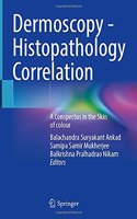 Dermoscopy - Histopathology Correlation