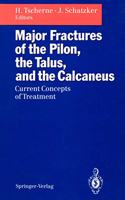 MAJOR FRACTURES OF THE PILON THE TALUS