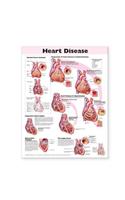 Heart Disease Anatomical Chart