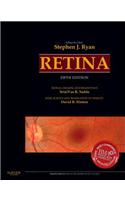 Retina