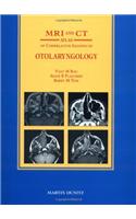 MRI and CT Atlas of Correlative Imaging in Otolaryngology