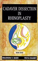 Cadaver dissection in rhinoplasty