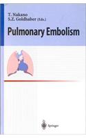 Pulmonary Embolism