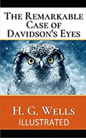 The Remarkable Case of Davidson's Eyes Illustrated