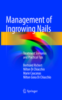 Management of Ingrowing Nails