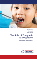 Role of Tongue in Malocclusion