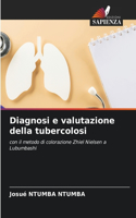 Diagnosi e valutazione della tubercolosi