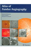 Atlas of Fundus Angiography