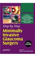 Step by Step Minimally Invasive Cataract Surgery