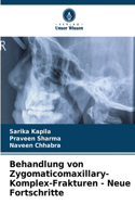 Behandlung von Zygomaticomaxillary-Komplex-Frakturen - Neue Fortschritte