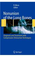 Nonunion of the Long Bones
