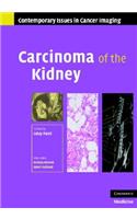 Carcinoma of the Kidney