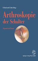 Arthroskopie Der Schulter