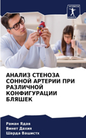 АНАЛИЗ СТЕНОЗА СОННОЙ АРТЕРИИ ПРИ РАЗЛИЧН