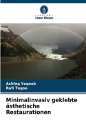 Minimalinvasiv geklebte ästhetische Restaurationen