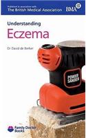 Understanding Eczema