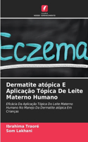 Dermatite atópica E Aplicação Tópica De Leite Materno Humano