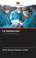 liposuccion