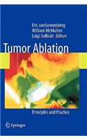 Tumor Ablation