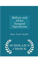 Before and After Surgical Operations - Scholar's Choice Edition