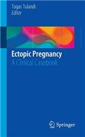 Ectopic Pregnancy