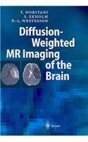 Diffusion-Weighted MR Imaging of the Brain