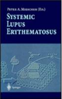Systemic Lupus Erythematosus
