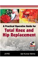 A Practical Operative Guide for Total Knee and Hip Replacement (with DVD-ROM)